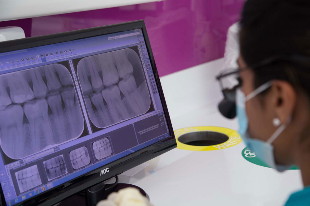 Dental X-Ray Maven Dental