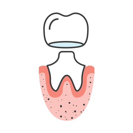 Maven Dental Crowns