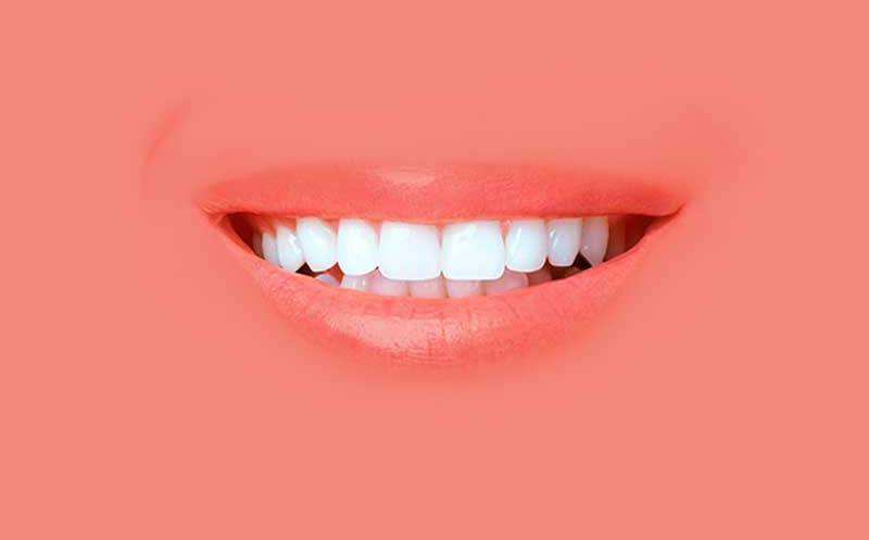 Teeth Straightening Options
