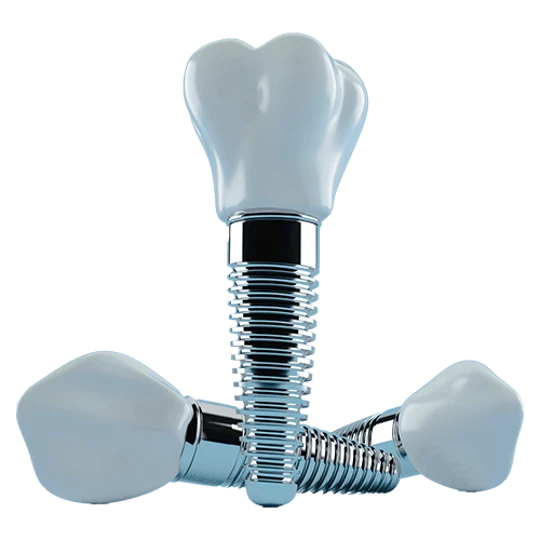 Dentalimplants Stylised 700X600