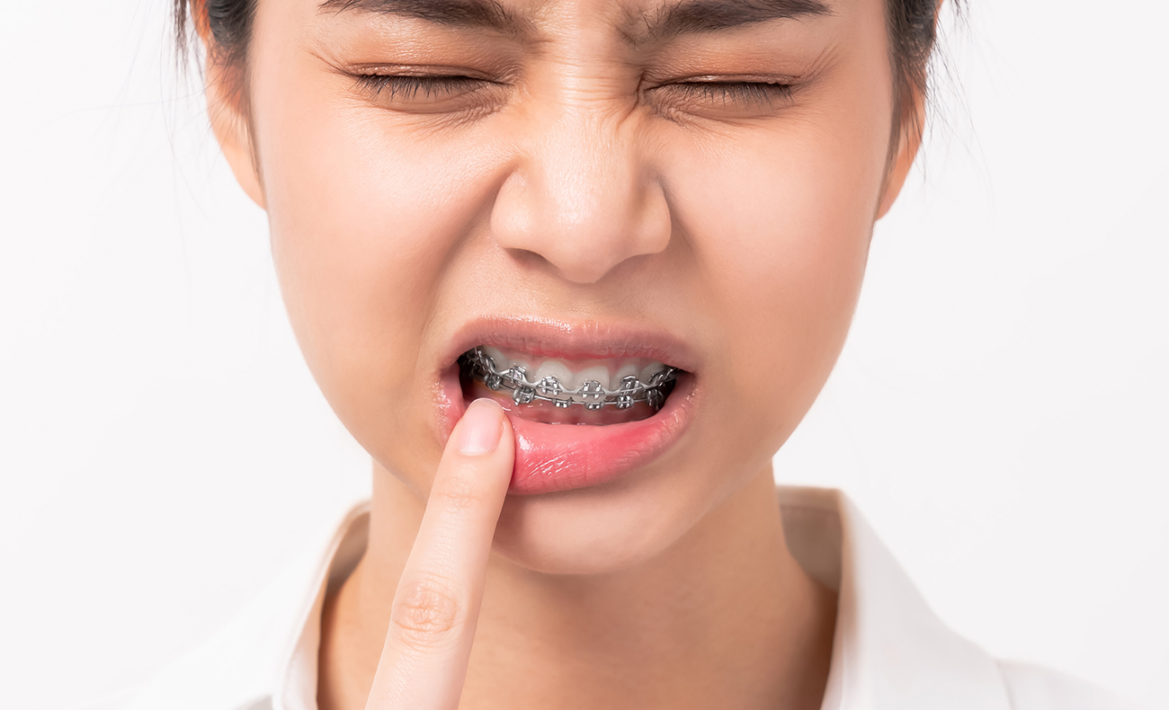 Brace Yourself It's All About Oral Hygiene Maven Dental