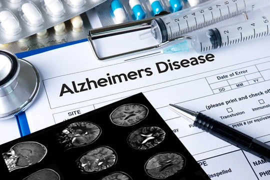 Istock 648706624 Alzcheimers Disease Optimised