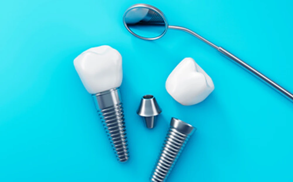 Dental Implant Banner Web